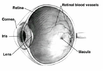 Edema